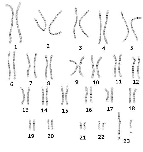 chromosomes23