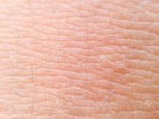 Το ανθρώπινο δέρμα χάνει περίπου ένα εκατομμύριο κύτταρα την ημέρα.