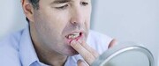 Ευαισθησία. Αν πίνεις παγωμένα ή πολύ ζεστά και πονάς αυτό μάλλον σημαίνει πως έχεις κάποια υπερευαισθησία. Ίσως χρειαστεί να αλλάξεις οδοντόκρεμα και να πάρεις μία για ευαίσθητα δόντια.