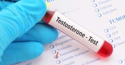 Ένα πολύ σημαντικό ερώτημα αναφέρεται στο ενδεχόμενο παρενεργειών από την πρόσληψη τεστοστερόνης. 