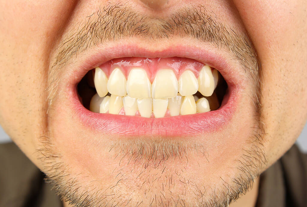 Σύμφωνα με τους οδοντιάτρους διαφέρουν από άνθρωπο σε άνθρωπο οι λόγοι που τρίζει τα δόντια του και έχουν να κάνουν με την ηλικία αλλά και τον τρόπο ζωής του. «Μελέτες υποστηρίζουν ότι το συναισθηματικό στρες είναι ο Νο1 παράγοντας για το τρίξιμο των δοντιών. Υπάρχουν επίσης μελέτες που υποστηρίζουν ότι και τα γονίδια παίζουν ρόλο ενώ υπάρχουν και συσχετίσεις με διάφορες ασθένειες όπως το σύνδρομο Down και οι διαταραχές ύπνου και διατροφής» αναφέρει ο οδοντίατρος δρ. Jarrett L. Manning.

