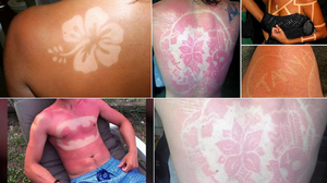 Η πιο ηλίθια μόδα του καλοκαιριού, είναι τα «Sunburn tattoos»
