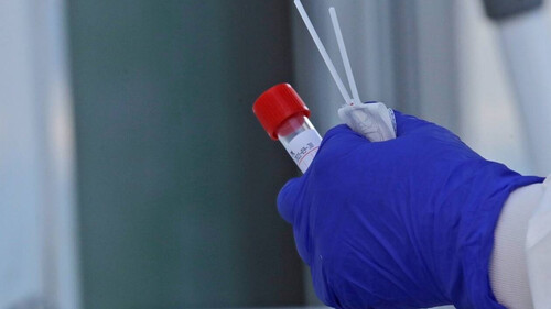 Κορονοϊός: «Βόμβα» από επιστήμονες - Τι θα αποκαλύψει την πραγματική εξάπλωση του ιού