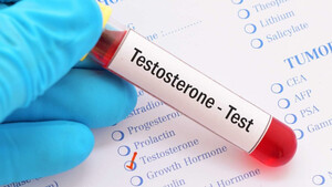 Πώς θα καταλάβεις αν έχεις έλλειψη τεστοστερόνης;